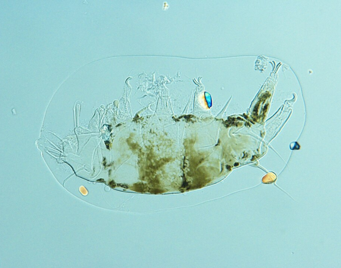 microscopic view of a Heterotardigrada