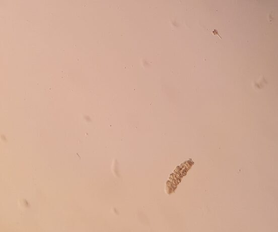  small tardigrade under the microscope