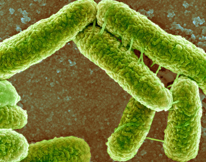 amplification of a coloured bacteria E. Coli