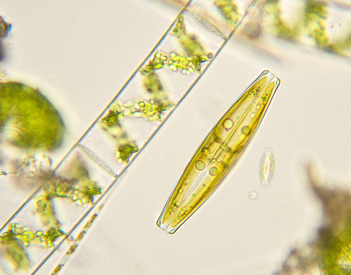microscopic view of diatoms