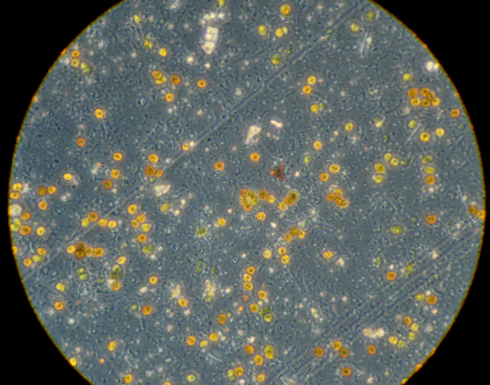 Zooxanthellae microscopic view